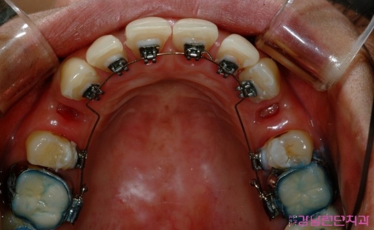 치아교정 치과 3.jpg