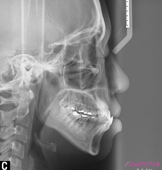 치아교정 치과 1.jpg