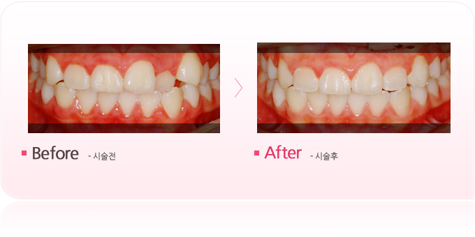 오희주-타임교정1.jpg