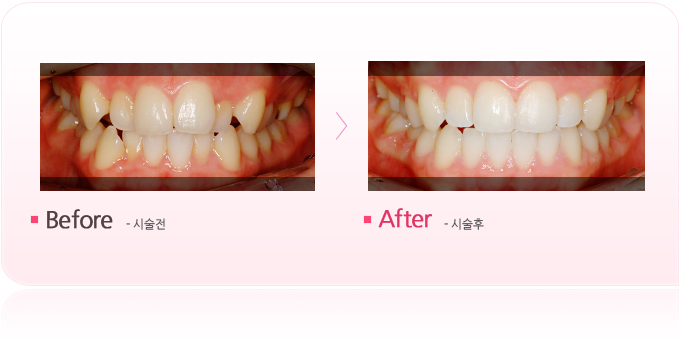 타임교정1.jpg