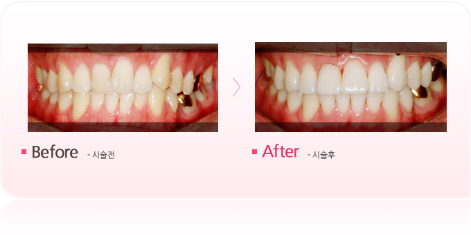 부분교정.jpg