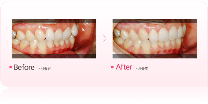 타임교정1_2.jpg
